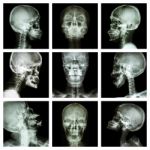 Collection Of Asian Skull (thai People) Stock Photo