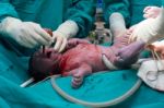 Cesarean Section Stock Photo