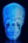 Skull X-rays Image With  Computer Chip And Circuit Mainboard Stock Photo