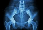 Film X-ray Of Pelvis Stock Photo