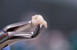 Dental Equipment Holding An Extracted Tooth Stock Photo