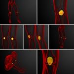 3d Rendering Medical Illustration Of The Patella Bone Stock Photo