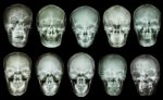 Collection Of Asian Skull (anterior View) (thai People) Stock Photo