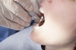 Dental Cleaning Close-up Stock Photo