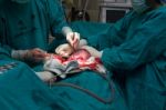 Cesarean Section Stock Photo