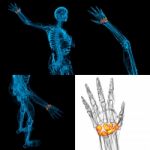 3d Rendering Illustration Of The Human Carpal Bones Stock Photo