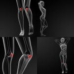 3d Rendering Illustration Of The  Patella Bone Stock Photo