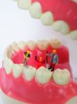 Miniature Worker On Plastic Teeth Of Removable Denture. Dental H Stock Photo