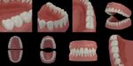 3d Render Teeth On Black Background Stock Photo