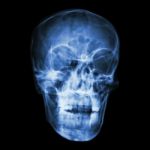 Asian People's Skull (thai People) Stock Photo