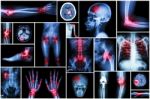 Collection X-ray Multiple Disease (arthritis,stroke,brain Tumor,gout,rheumatoid,kidney Stone,pulmonary Tuberculosis,osteoarthritis Knee, Etc) Stock Photo