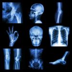 Collection X-ray Part Of Human Stock Photo