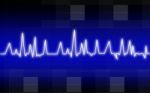 Heart Pulse Stock Photo