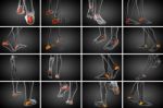 3d Rendering Medical Illustration Of The Calcaneus Bone Stock Photo