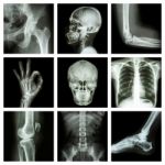 Collection X-ray Part Of Human Stock Photo