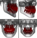 Medical Illustration Of The Tooth On Background Stock Photo