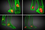 3d Rendering Medical Illustration Of The Calcaneus Bone Stock Photo