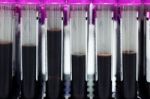 Tubes Blood Sample In Rack Stock Photo