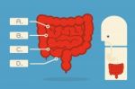 Intestines Infographics Stock Photo