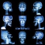 Collection Of Asian Skull (thai People) Stock Photo