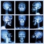 Collection Of Asian Skull (thai People) Stock Photo