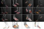 3d Rendering Medical Illustration Of The Metatarsal Bones Stock Photo