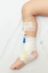 Bandage On Babys Leg Stock Photo