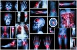 X-ray Multiple Disease Stock Photo