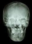 Normal Human Skull Stock Photo