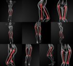 3d Rendering Illustration Of The Femur Bone Stock Photo