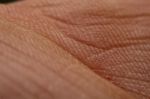 Human Skin Stock Photo