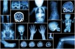 X-ray Multiple Part Of Child 's Body & Multiple Disease ( Stroke , Brain Tumor , Rheumatoid Arthritis , Sinusitis , Gouty Arthritis , Etc)( Skull Chest Lung Heart Spine Arm Hand Pelvis Leg Knee Foot ) Stock Photo