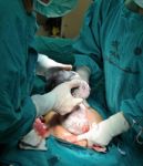 Cesarean Section Stock Photo