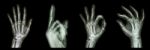 Collection X-ray Symbol Hands Stock Photo