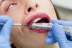 Dentist Curing A Female Patient Stock Photo