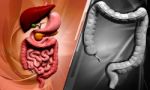 Human Digestive System Stock Photo