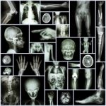 Collection X-ray "multiple Part Of Human,orthopedic Surgery And Multiple Disease" (fracture,pulmonary Stock Photo