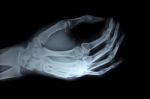 X-ray Hand Stock Photo