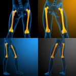 3d Rendering Medical Illustration Of The Femur Bone Stock Photo