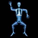 Aerobic Dance(human Bone Is Dancing),(whole Body X-ray : Head ,neck ,thorax ,shoulder ,arm ,elbow ,forearm ,hand ,finger ,joint ,thorax ,abdomen ,back,pelvis ,hip ,thigh ,leg ,knee ,foot ,heel ,ankle) Stock Photo