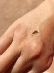 Mosquito Sucking Blood On Human Skin Stock Photo