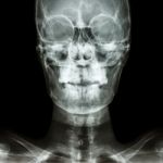 Normal Human's Skull And Blank Area At Right Side Stock Photo