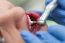 Close-up Medical Dentist Procedure Of Teeth Polish