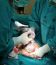 Cesarean Section