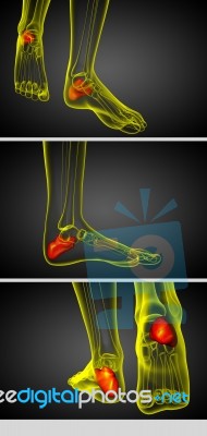 3d Render Medical Illustration Of The Calcaneus Bone Stock Image