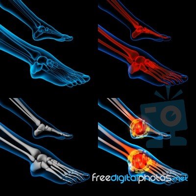 3d Rendering Human Foot Pain With The Anatomy Of A Skeleton Foot… Stock Image