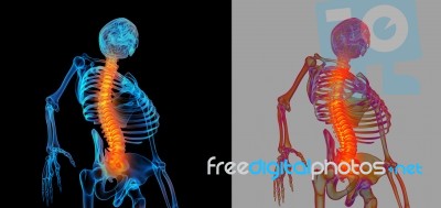 3d Rendering Human Of Painful Spine Stock Image