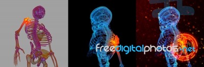 3d Rendering Human Of Shoulder Pain Stock Image