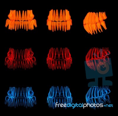 3d Rendering Human Orange Teeth - Back View Stock Image