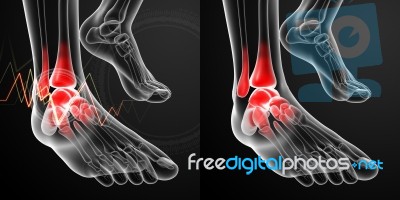 3d Rendering Illustration Of The Ankle Pain Stock Image